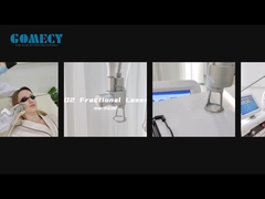 ফ্রেকশনাল সিও২ লেজার ত্বকের পুনরুজ্জীবন ত্বকের টান